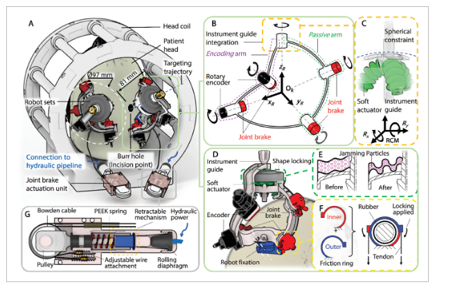 Overview of the robotic system implementation within an MRI head coil